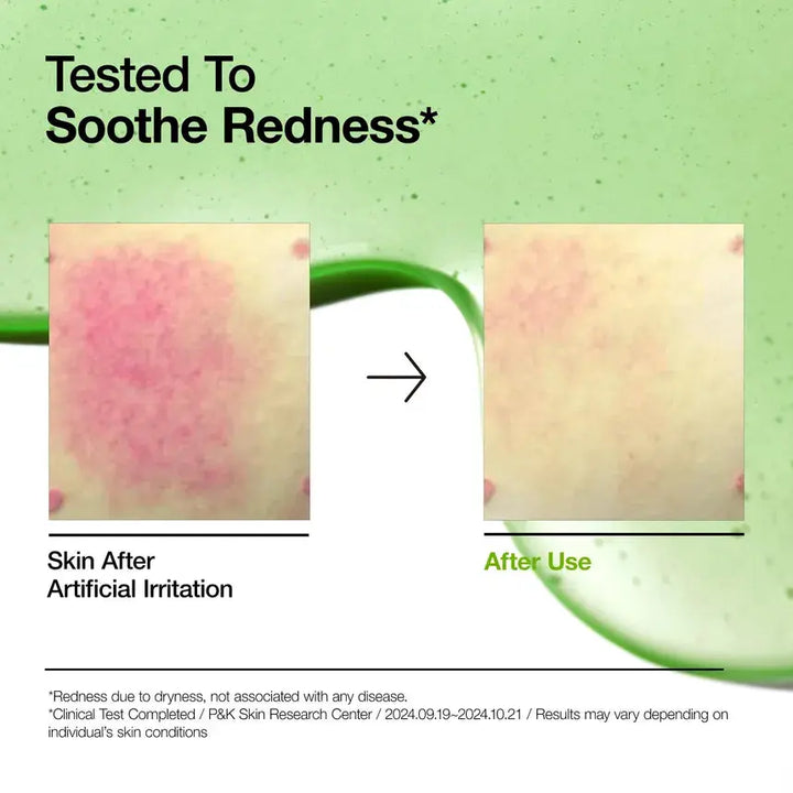 ANUA Azelaic Acid 10 Soothing Serum 30ml