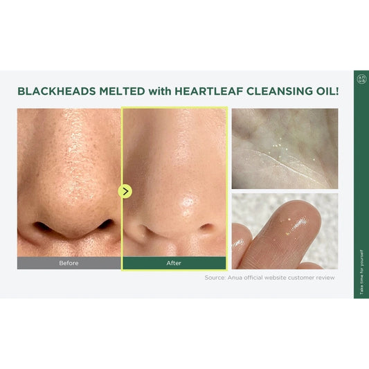 Anua Heartleaf Pore Control Cleansing Oil