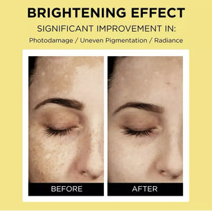 Vari-Hope 8 Days Pure Vitamin C Serum