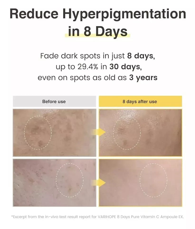 Vari-Hope 8 Days Pure Vitamin C Serum