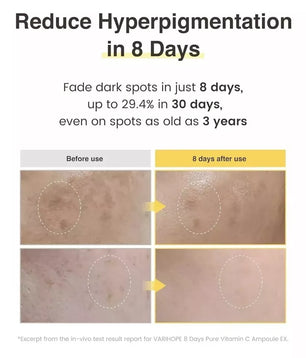 Vari-Hope 8 Days Pure Vitamin C Serum